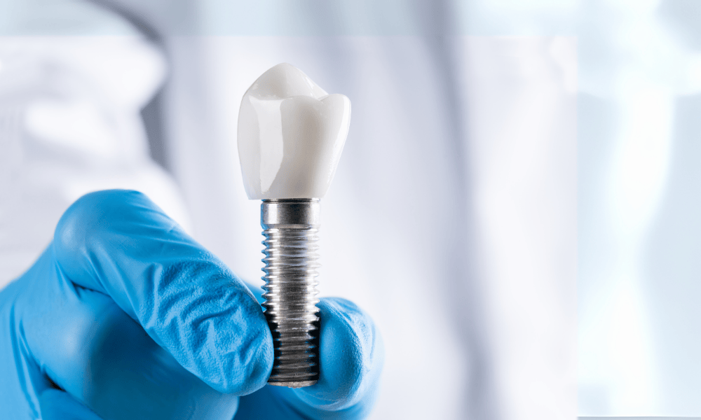 Why Choose Pearland dental care for Dental Implants?