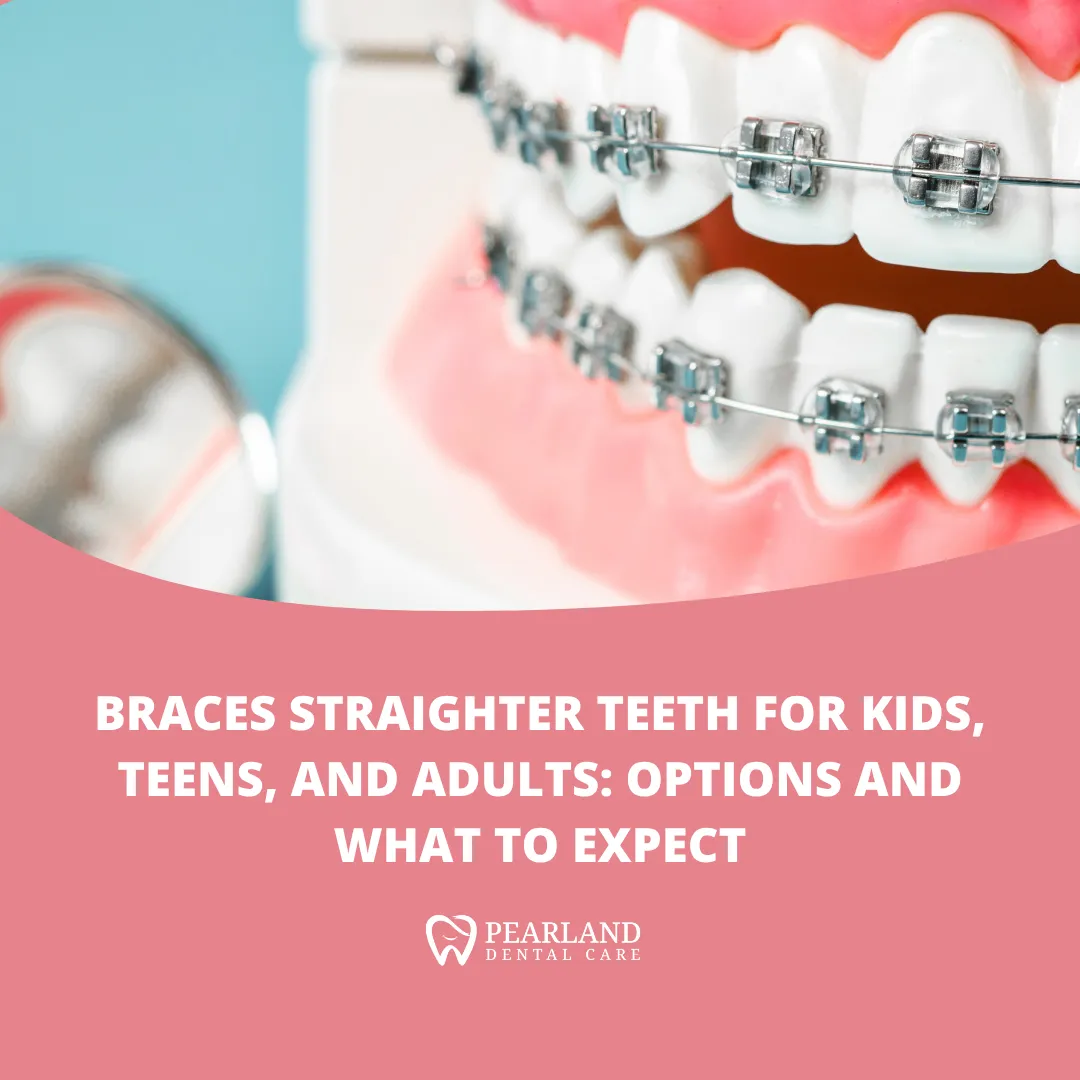 Braces for Straighter Teeth for Kids, Teens, and Adults: Options and What to Expect