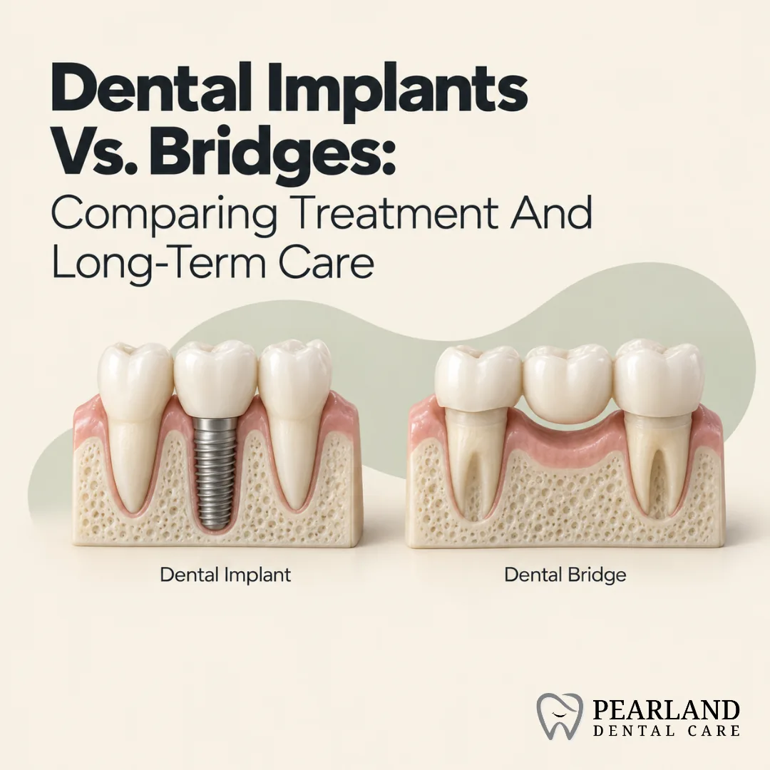 Dental Implants Vs. Bridges: Comparing Treatment And Long-Term Care