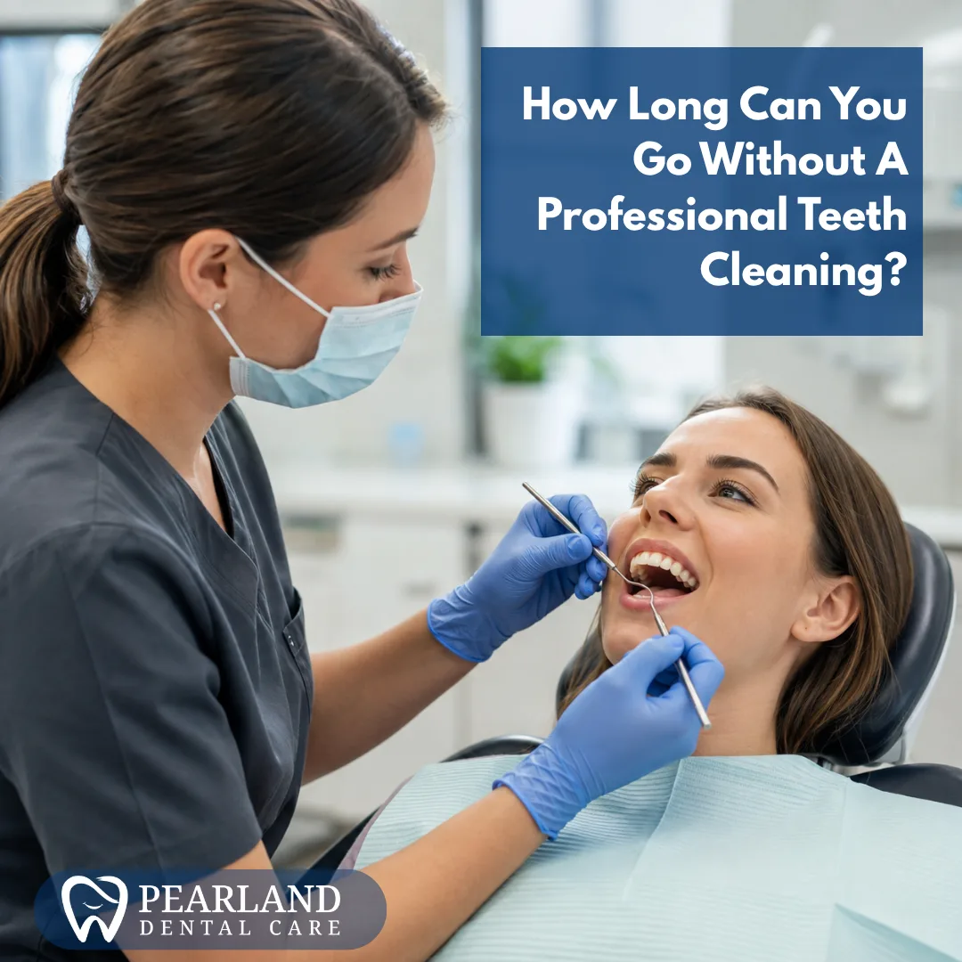 How Long Can You Go Without A Professional Teeth Cleaning?