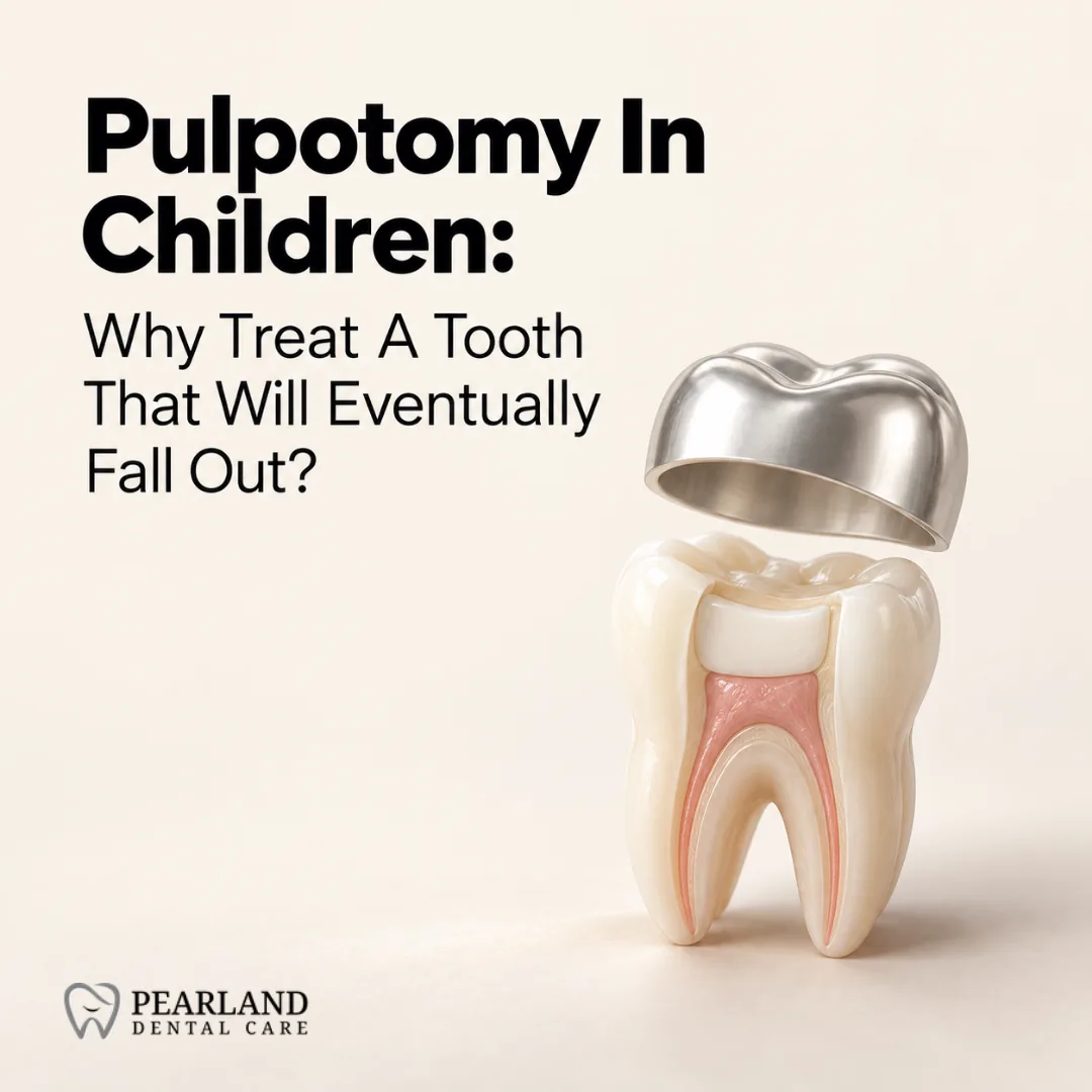 Pulpotomy In Children: Why Treat A Tooth That Will Eventually Fall Out?