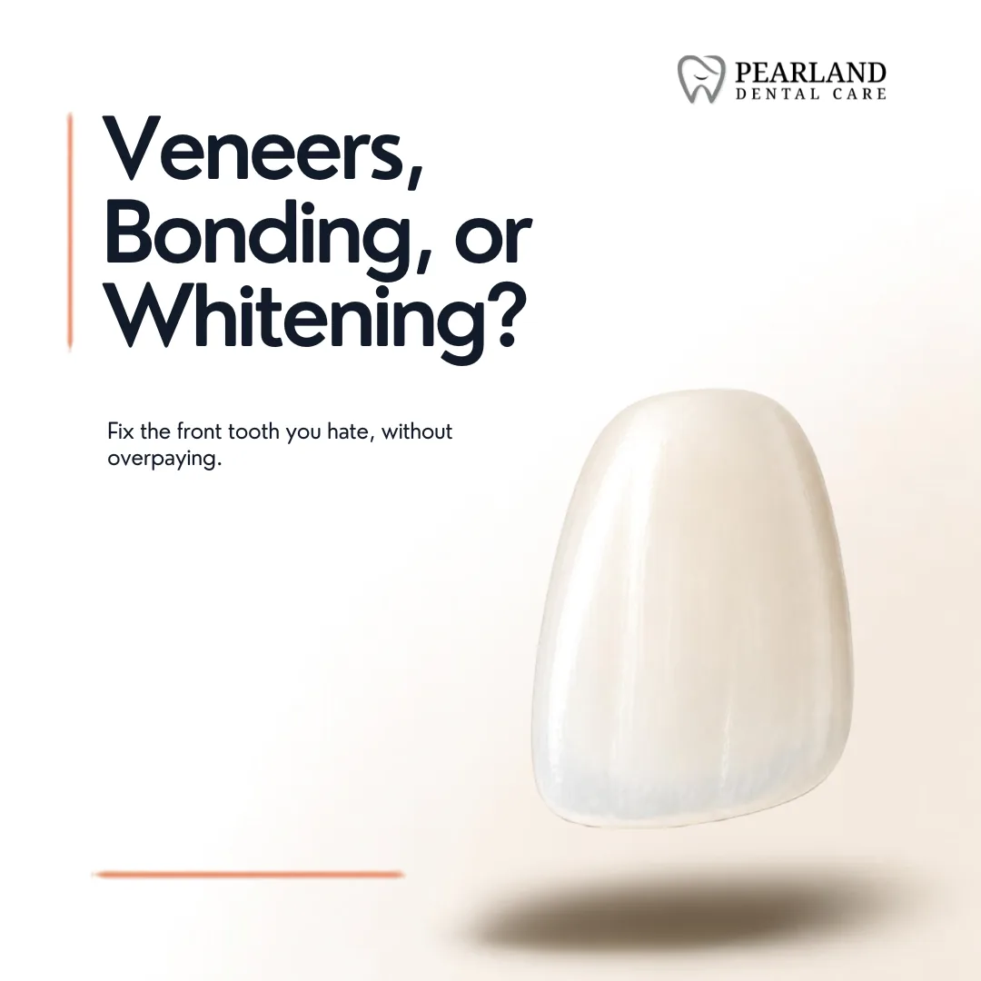 Veneers, Bonding, or Whitening: How to Fix the Front Tooth You Hate — Without Overpaying