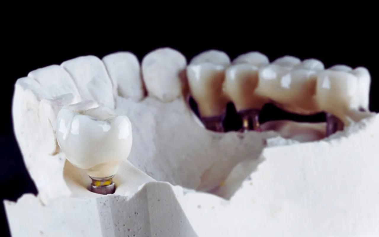 Bridges at Pearland Dental Care, Pearland TX